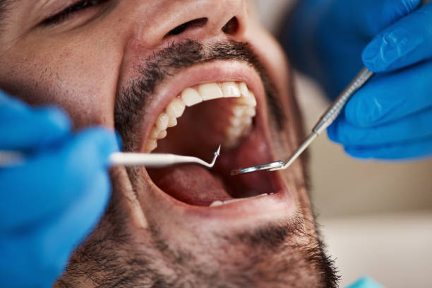 Best Emergency Dental Surgery in Columbia, KY